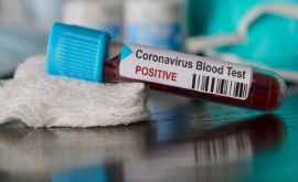 Cîte persoane au fost testate pentru coronavirus în RMoldova