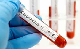 Un angajat din cabinetul fracțiunii PAS testat pozitiv la coronavirus