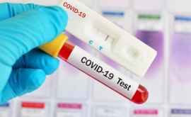 Autoritățile vor cumpăra încă 100 mii de teste pentru diagnosticarea infecției COVID19