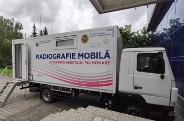 Examinarea gratuită a cutiei toracice: În ce sate vor ajunge echipele mobile de medici
