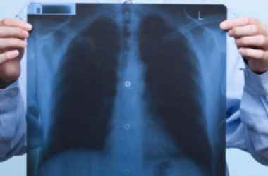 Как часто можно делать рентгенографию легких? 