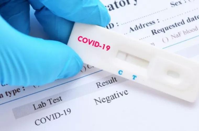 377 cazuri de COVID-19, înregistrate în ultimele 24 ore