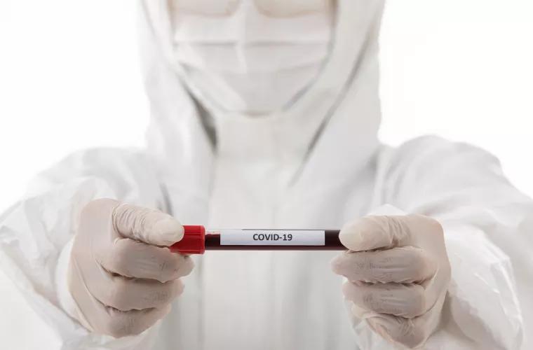 831 cazuri noi de infectare cu COVID-19 au fost confirmate astăzi în Republica Moldova
