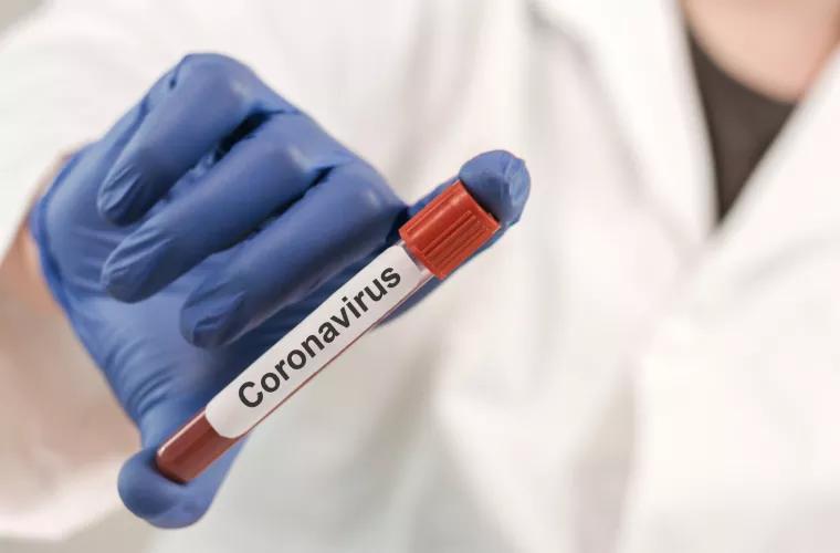Alte 49 de cazuri noi de infectare cu COVID-19 au fost confirmate astăzi în Moldova