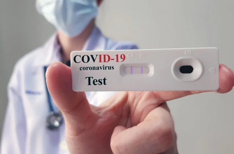 Alte 376 de cazuri noi de infectare cu COVID-19, confirmate în R. Moldova