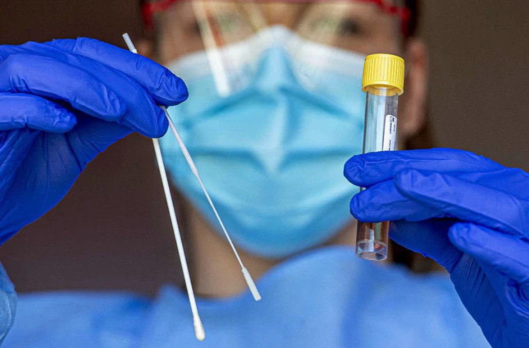 В Молдове подтвержден 3971 новый случай коронавируса