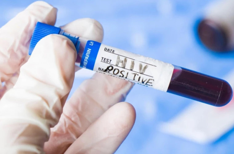 O echipă de cercetători a anunțat că este posibil să fi vindecat o femeie de HIV