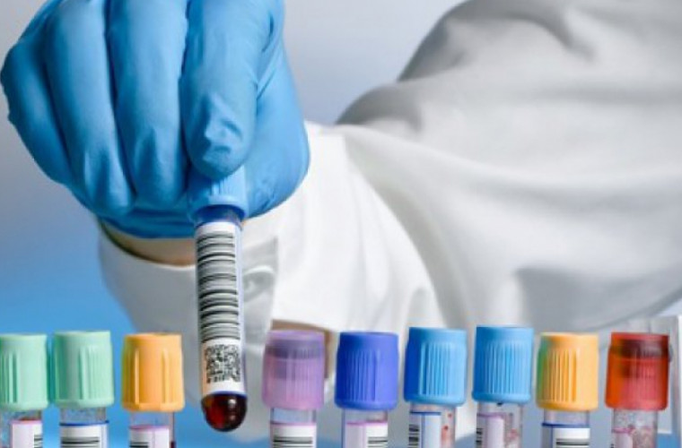Analiza de sînge care depistează pînă la 8 tipuri de cancer