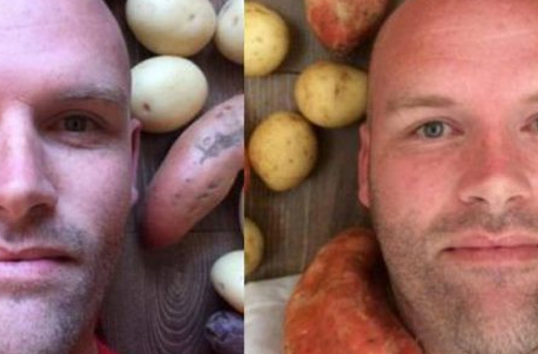 Un bărbat a mîncat doar cartofi timp de un an: ce a păţit