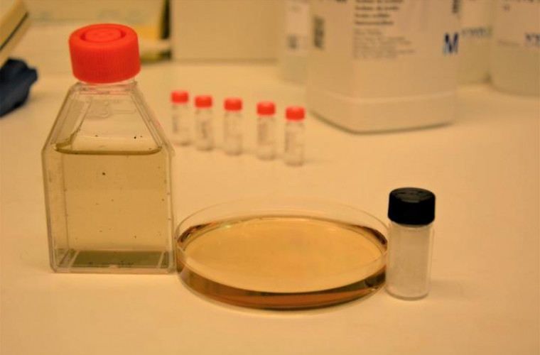 Microbii din lacurile humice produc omega-3 din microplastic
