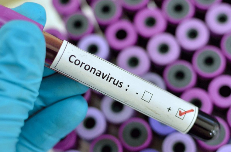 32 cazuri noi de infecție cu coronavirus în Republica Moldova. Doar unul de import
