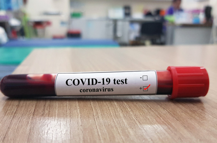 Ultima oră! Încă 112 de moldoveni, testați pozitiv la Coronavirus