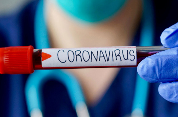 Alte 104 cazuri de coronavirus, confirmate în Republica Moldova