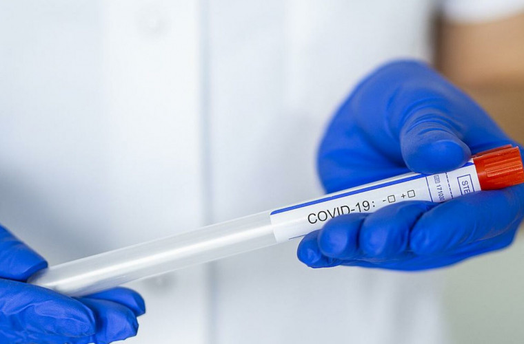 Încă 158 de moldoveni s-au infectat cu noul coronavirus