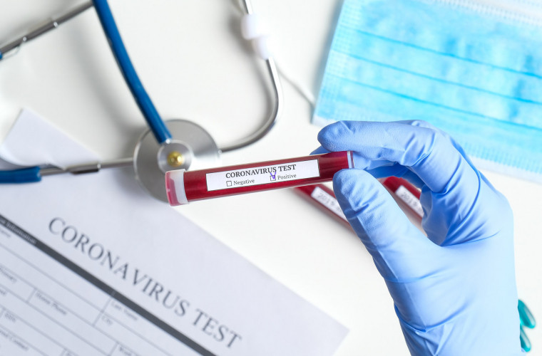 Alți 364 de moldoveni s-au infectat cu noul coronavirus