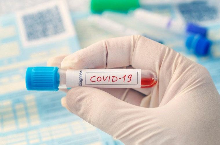 Alte 350 cazuri noi de infectare cu COVID-19, confirmate în R. Moldova