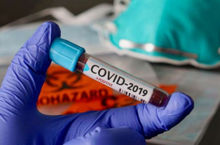 В Румынии коронавирус выявили еще у 1318 человек