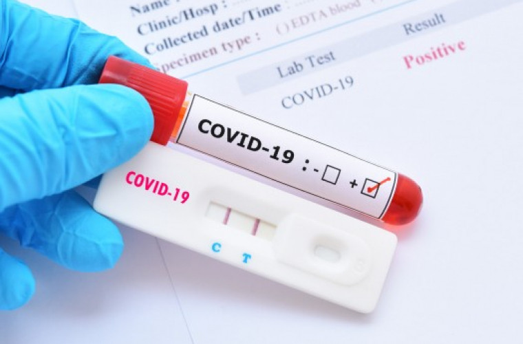 567 cazuri noi de infectare cu COVID-19 au fost confirmate în ultimele 24 de ore 