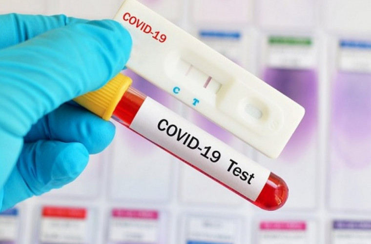 Autoritățile vor cumpăra încă 100 mii de teste pentru diagnosticarea infecției COVID-19